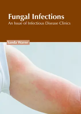 Pilzinfektionen: Eine Ausgabe von Infectious Disease Clinics - Fungal Infections: An Issue of Infectious Disease Clinics