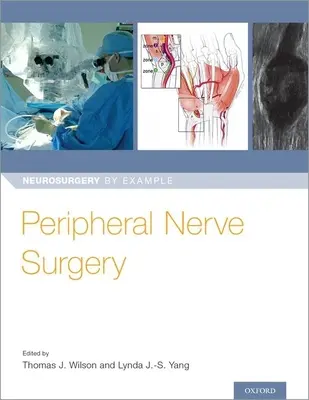 Periphere Nervenchirurgie - Peripheral Nerve Surgery