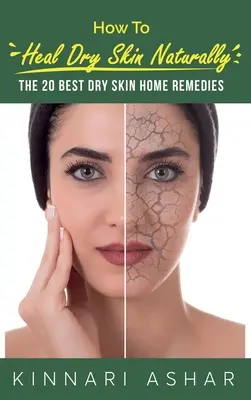 Wie man trockene Haut natürlich heilt: Die 20 besten Hausmittel gegen trockene Haut - How to Heal Dry Skin Naturally: The 20 Best Dry Skin Home Remedies