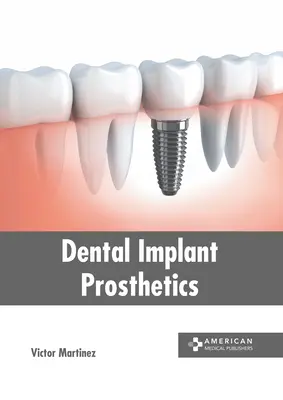 Zahnärztliche Implantatprothetik - Dental Implant Prosthetics