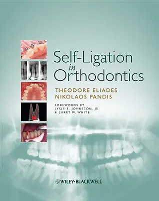 Selbstligatur in der Kieferorthopädie: Ein evidenzbasierter Ansatz für Biomechanik und Behandlung - Self-Ligation in Orthodontics: An Evidence-Based Approach to Biomechanics and Treatment