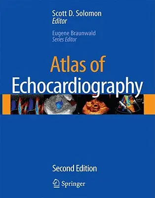 Atlas der Echokardiographie [mit CDROM] - Atlas of Echocardiography [With CDROM]