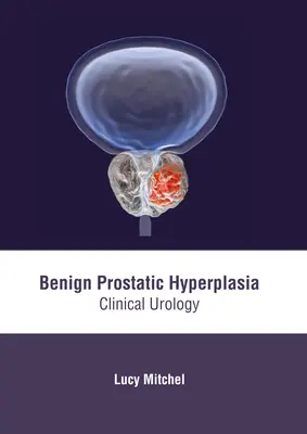 Benigne Prostatahyperplasie: Klinische Urologie - Benign Prostatic Hyperplasia: Clinical Urology