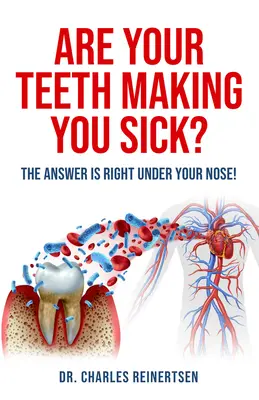 Werden Sie von Ihren Zähnen krank?: Die Antwort liegt direkt vor Ihrer Nase - Are Your Teeth Making You Sick?: The Answer Is Right Under Your Nose