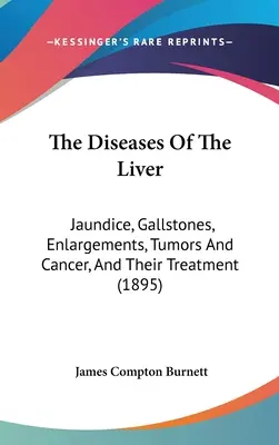 Die Krankheiten der Leber: Gelbsucht, Gallensteine, Vergrößerungen, Tumore und Krebs, und ihre Behandlung (1895) - The Diseases Of The Liver: Jaundice, Gallstones, Enlargements, Tumors And Cancer, And Their Treatment (1895)