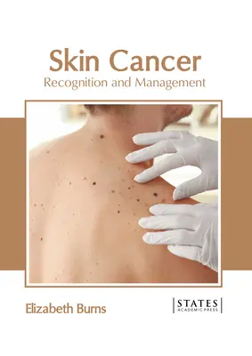 Hautkrebs: Erkennung und Behandlung - Skin Cancer: Recognition and Management