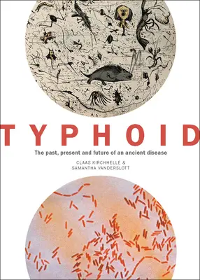 Typhus: Vergangenheit, Gegenwart und Zukunft einer uralten Krankheit - Typhoid: The Past, Present, and Future of an Ancient Disease
