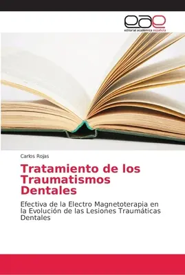 Behandlung von Zahntraumata (Tratamiento de los Traumatismos Dentales) - Tratamiento de los Traumatismos Dentales