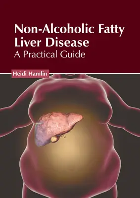 Nicht-alkoholische Fettlebererkrankung: Ein praktischer Leitfaden - Non-Alcoholic Fatty Liver Disease: A Practical Guide