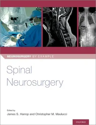 Neurochirurgie der Wirbelsäule - Spinal Neurosurgery