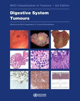 Tumore des Verdauungssystems: Die Klassifizierung von Tumoren - Digestive System Tumours: Who Classification of Tumours