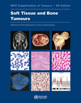 Weichteil- und Knochentumore: Die Klassifizierung von Tumoren - Soft Tissue and Bone Tumours: Who Classification of Tumours