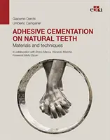 Adhäsive Zementierung auf natürlichen Zähnen - Materialien und Techniken - Adhesive cementation on natural teeth - Materials and techniques