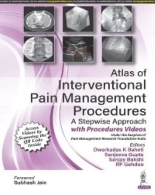 Atlas der interventionellen Schmerzbehandlungsverfahren - Atlas of Interventional Pain Management Procedures