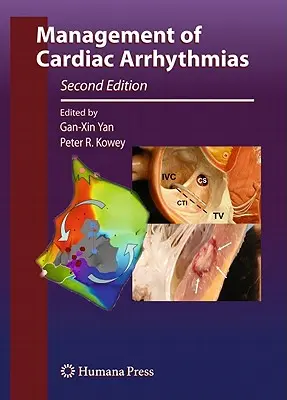 Management von Herzrhythmusstörungen - Management of Cardiac Arrhythmias