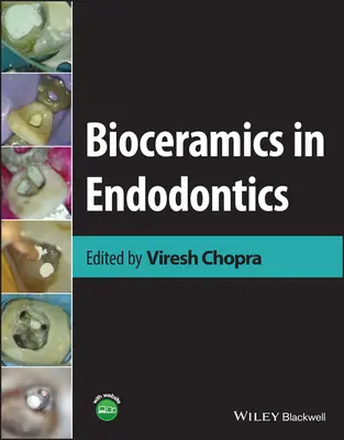 Biokeramik in der Endodontie - Bioceramics in Endodontics