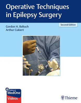 Operative Techniken in der Epilepsiechirurgie - Operative Techniques in Epilepsy Surgery