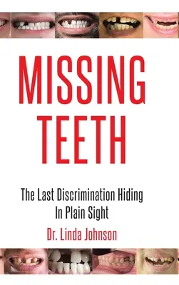 Fehlende Zähne: Die letzte Diskriminierung, die sich im Verborgenen abspielt - Missing Teeth: The Last Discrimination Hiding in Plain Sight
