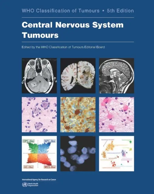 Tumore des Zentralnervensystems: Die Klassifizierung von Tumoren - Central Nervous System Tumours: Who Classification of Tumours