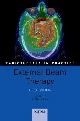 Externe Strahlentherapie - External Beam Therapy