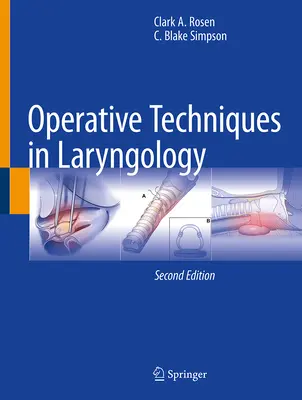 Operative Techniken in der Laryngologie - Operative Techniques in Laryngology
