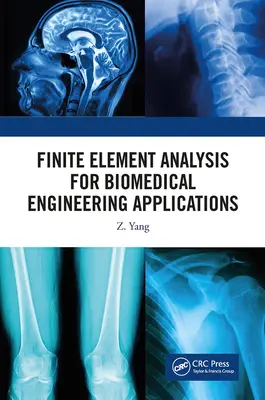 Finite-Elemente-Analyse für Anwendungen in der Biomedizintechnik - Finite Element Analysis for Biomedical Engineering Applications