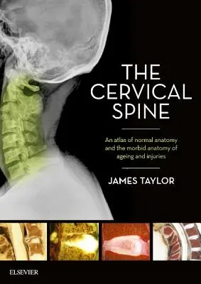 Die Halswirbelsäule: Ein Atlas der normalen Anatomie und der krankhaften Anatomie von Alterung und Verletzungen - The Cervical Spine: An Atlas of Normal Anatomy and the Morbid Anatomy of Ageing and Injuries