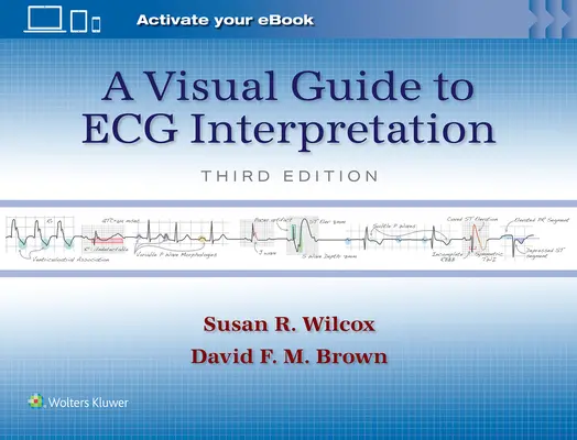 Visueller Leitfaden zur EKG-Interpretation - A Visual Guide to ECG Interpretation