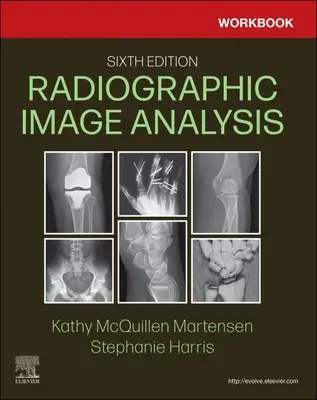 Arbeitsbuch für die radiologische Bildanalyse - Workbook for Radiographic Image Analysis