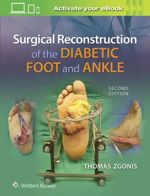 Chirurgische Rekonstruktion des diabetischen Fußes und Knöchels - Surgical Reconstruction of the Diabetic Foot and Ankle