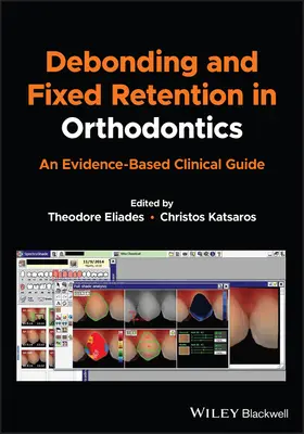 Debonding und festsitzende Retention in der Kieferorthopädie: Ein evidenzbasierter klinischer Leitfaden - Debonding and Fixed Retention in Orthodontics: An Evidence-Based Clinical Guide